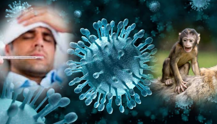 Más de 100 casos de viruela símica en una semana, ya suman 504