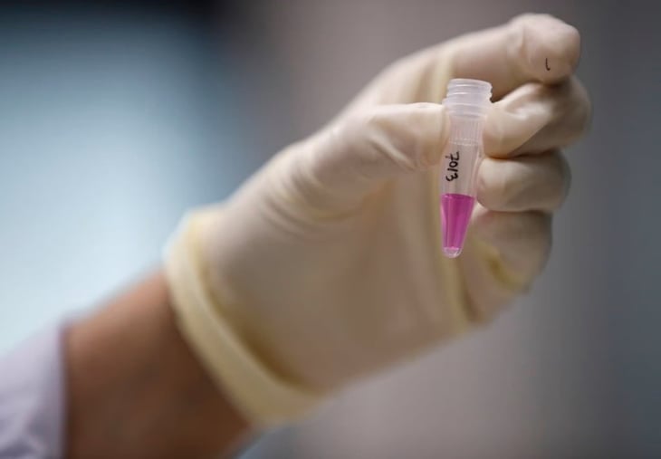 InDRE confirma 11 casos de viruela símica en Coahuila