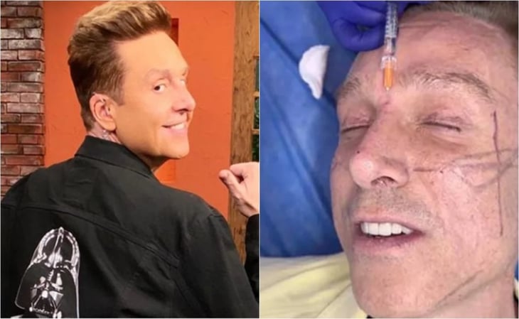 Daniel Bisogno se sometió a rejuvenecimiento facial, este fue el resultado
