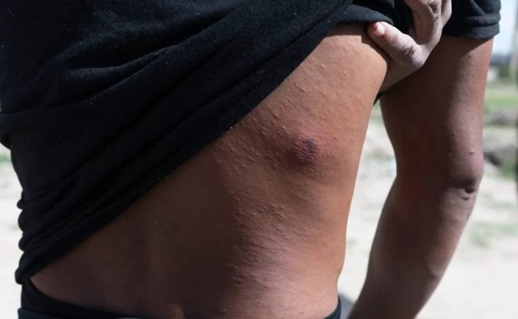 'Me dispararon una y otra vez', dice migrante venezolano agredido por Patrulla Fronteriza de EU