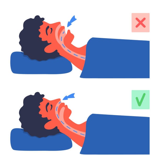 Respirar por la boca al dormir causa problemas de salud