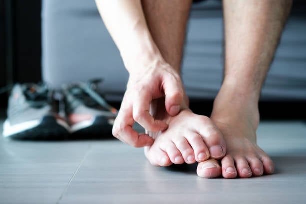 El pie de atleta: Síntomas, causas y cómo tratarlo