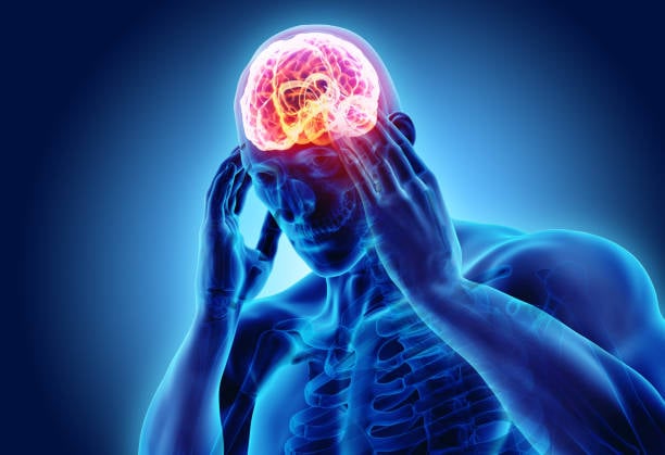 Tal vez sí es para tanto: ¿cuándo ir al médico por un dolor de cabeza?