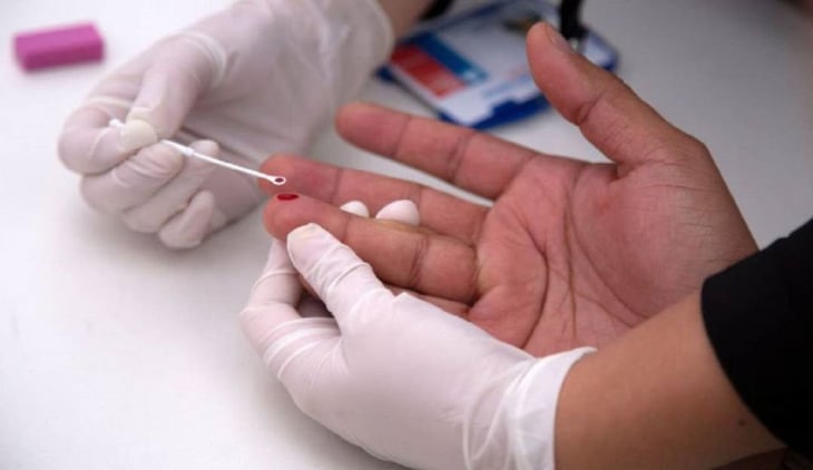 123 casos de sida son los que se atienden en el hospital Amparo Pape