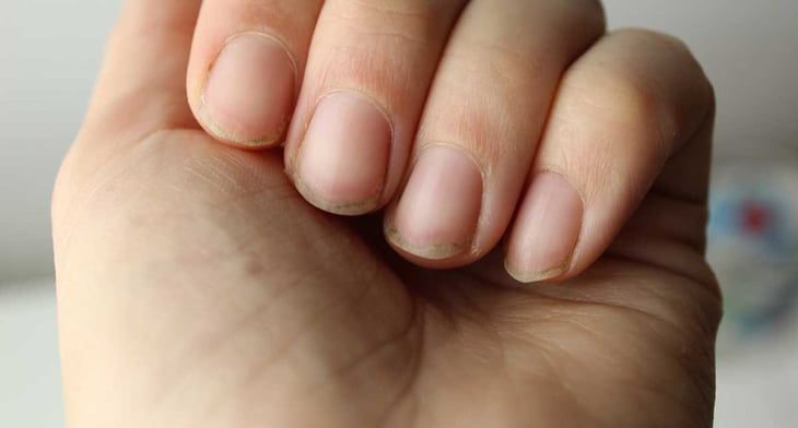 Estos tips ayudaran a dejarte de morder las uñas