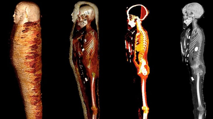 Chico de oro: la momia que fue enterrada con un 'corazón de oro' hace 2 mil 300 años en Egipto