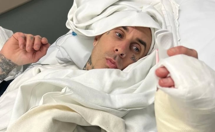 Blink-182: Travis Barker sube impactante fotografía de la operación en su dedo tras cancelación de gira