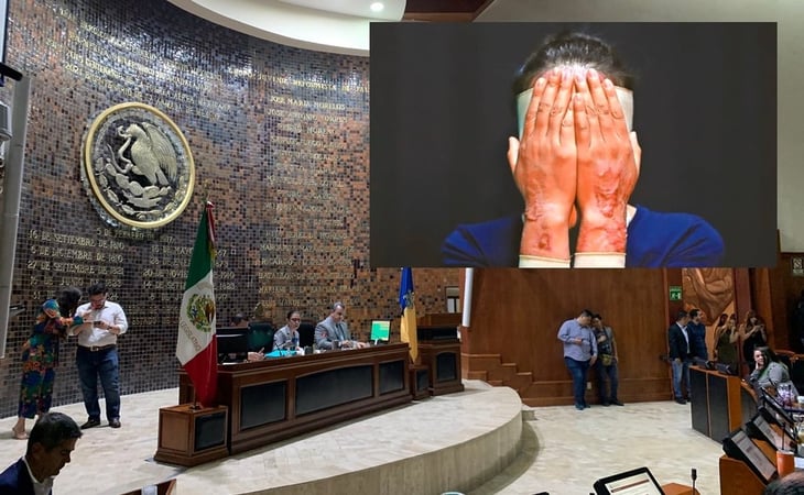 Congreso de Jalisco aprueba hasta 15 años de prisión por ataques con ácido contra mujeres