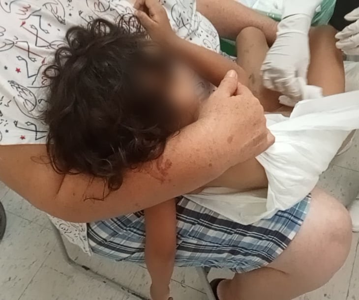 Niña de 3 años es atacada por un can en Monclova 