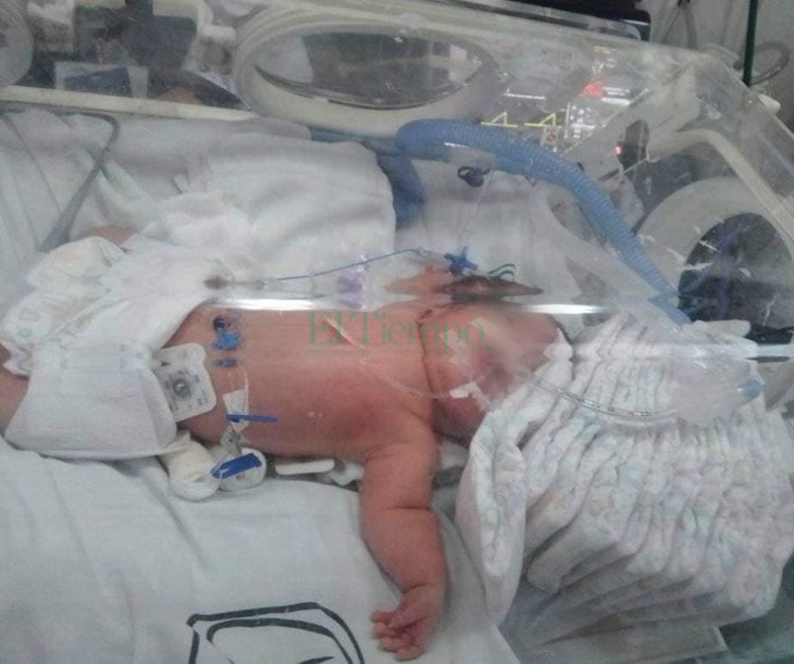 Victoria de 1 mes de nacida se debate entre la vida y la muerte