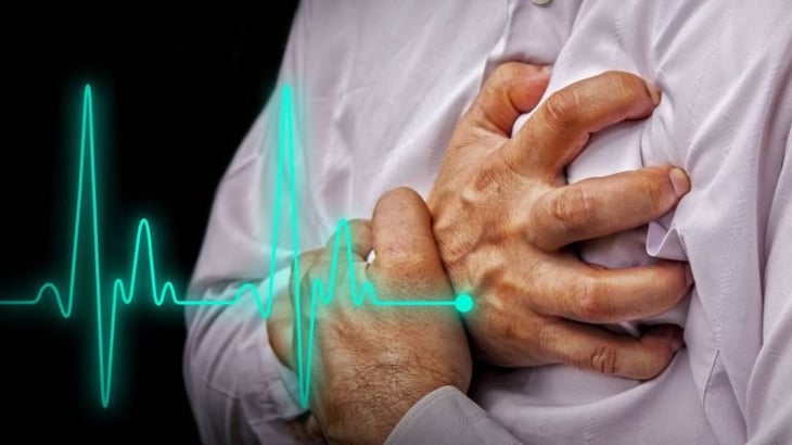 Sector salud pide mayor cuidado para prevenir un paro cardiaco