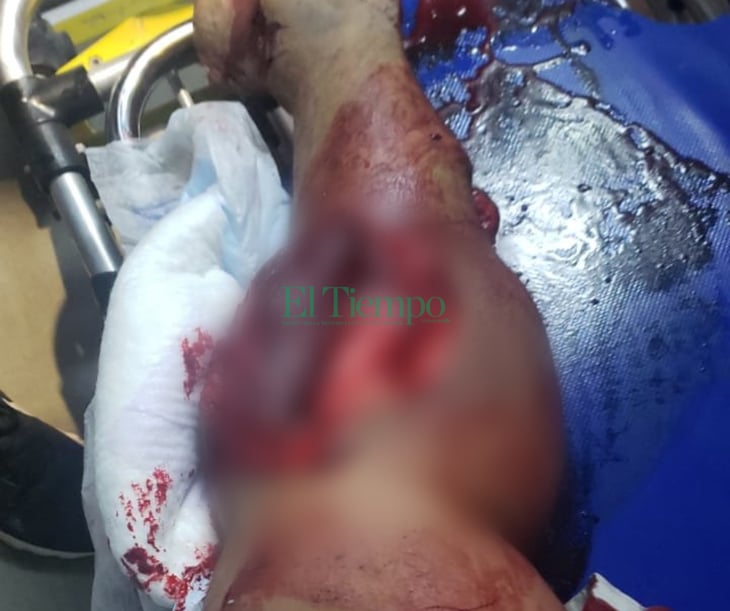 Motociclista se destroza pierna en carretera Monclova-Candela