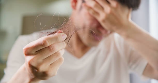 Consejos para prevenir la pérdida de cabello en hombres