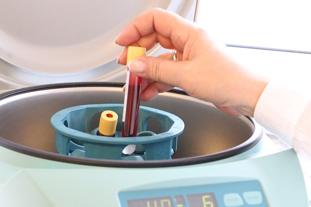 Los análisis de sangre podrían ser la respuesta para detectar tumores