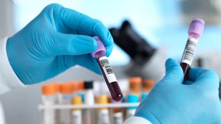 El prometedor examen de sangre para detectar más de 50 tipos de cáncer 