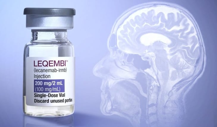 Leqembi: Los pros y contras del nuevo medicamento contra el alzheimer
