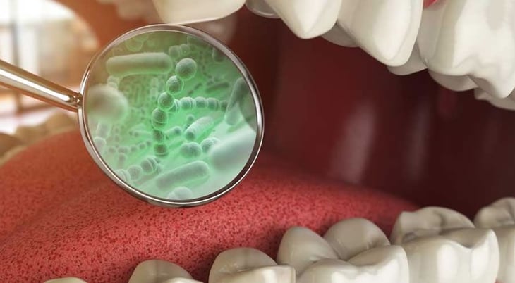 Microbiota oral e intestinal y ateroesclerosis