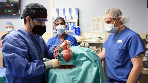 3 cuestiones éticas en torno a los trasplantes de corazón de cerdos en humanos