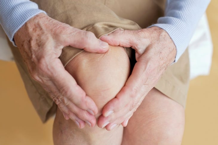 Osteoartrosis: ¿Qué es, cuáles son sus síntomas y factores de riesgo?