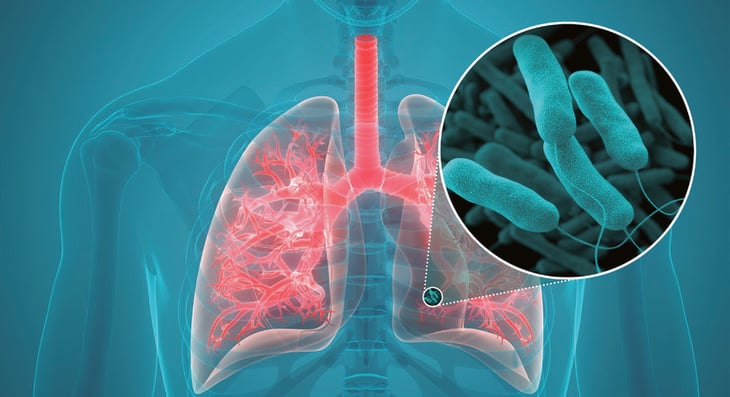 El diagnóstico preciso ante las infecciones respiratoria es la clave para evitar los antibióticos innecesarios