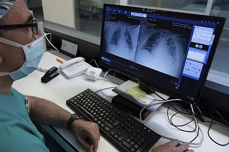 Menos de un 25% de los casos de cáncer de pulmón se detecta en una fase que facilite la curación