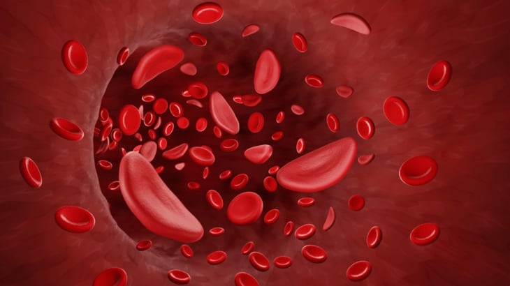 Anemia: ¿En qué consiste el padecimiento que afecta a una cuarta parte de la población?