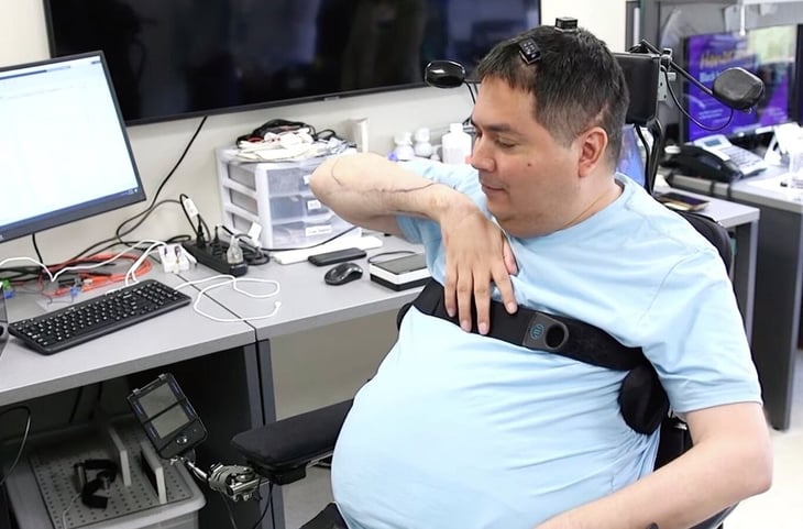 Implantes cerebrales e IA contra la parálisis: un paciente recupera la sensibilidad y el movimiento de sus brazos