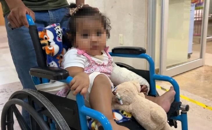 Accidente en triciclo le desprende el brazo a niña: médicos logran 'pegarlo' y salvar la extremidad