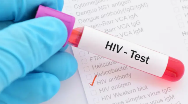 Aumenta VIH por desatención federal
