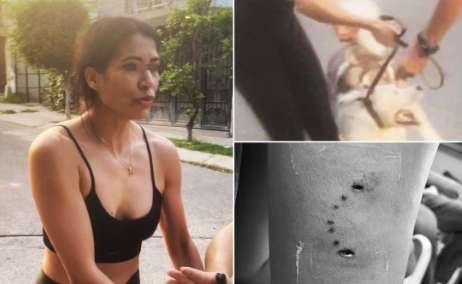 Denuncian a mujer por supuestamente ordenar a su perro husky matar a lomito de la calle en Tonalá
