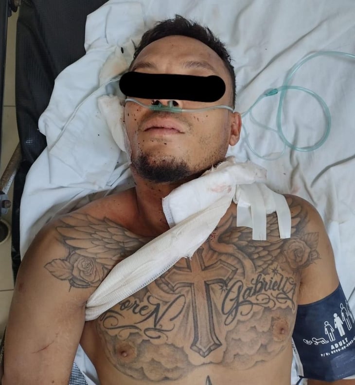 Hombre es agredido a navajazos por sus amigos de parranda