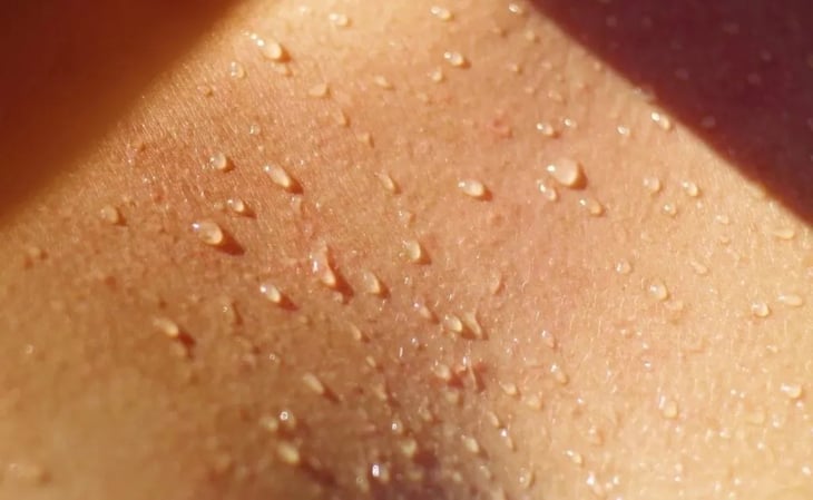 Estas son las causas del sudor excesivo, ¿es malo?