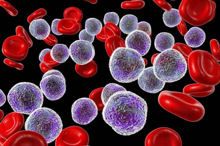 Células madre modificadas genéticamente ofrecen esperanza contra la anemia de células falciformes