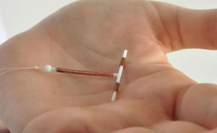 DIU de cobre: cómo funciona el anticonceptivo femenino