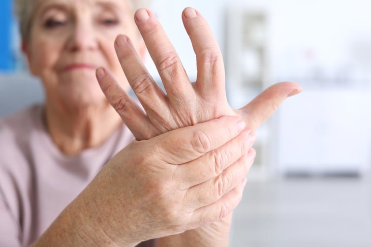 Tratamiento puente con esteroides para artritis reumatoide
