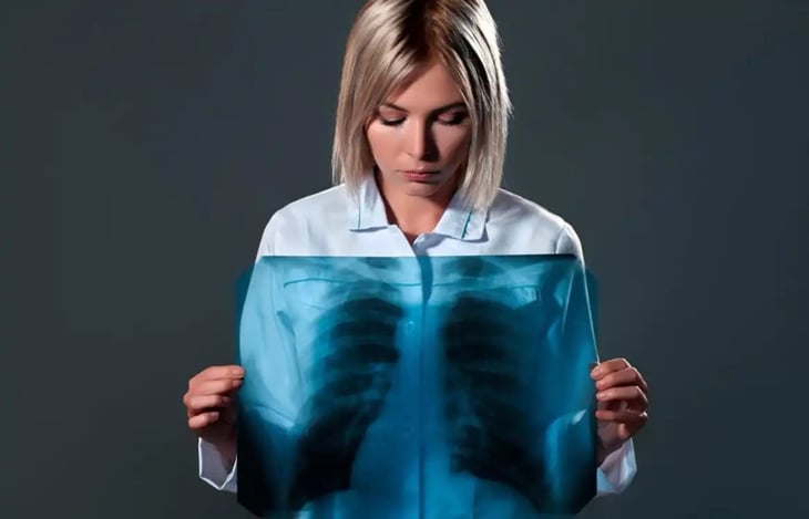Ocho síntomas que pueden alertar de un cáncer de pulmón temprano