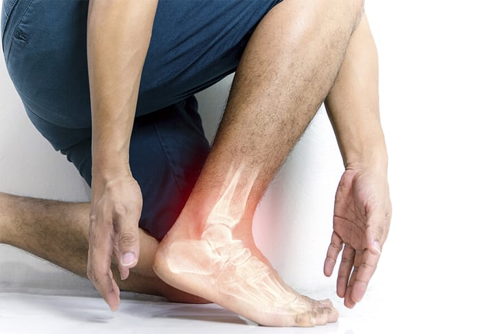 Lesiones musculares: ¿cómo reconocerlas y cómo tratarlas?