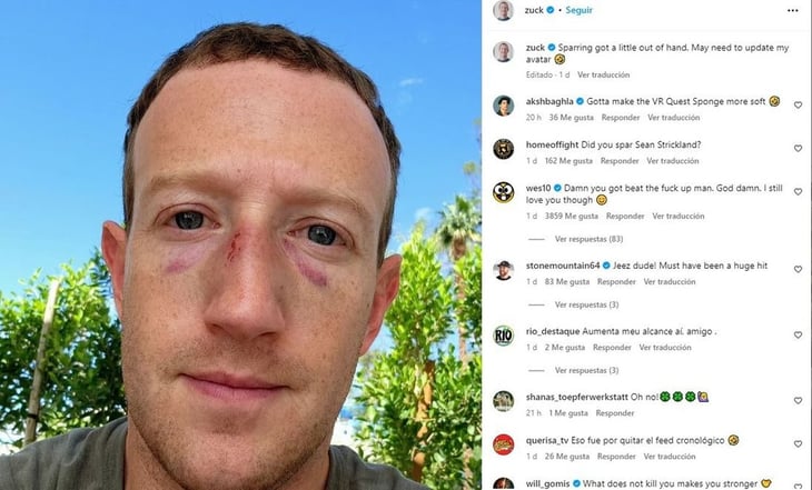 Mark Zuckerberg aparece con moretones en la cara: 'el combate se salió un poco de control'
