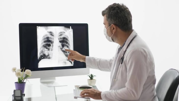 Una IA predice quién debe someterse a un cribado para cáncer de pulmón