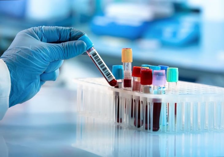 El análisis de sangre para detectar el cáncer de forma precoz que podría llegar en 2025