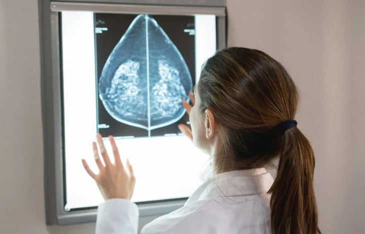 Principales beneficios de las semillas magnéticas en los tratamientos quirúrgicos de cáncer de mama