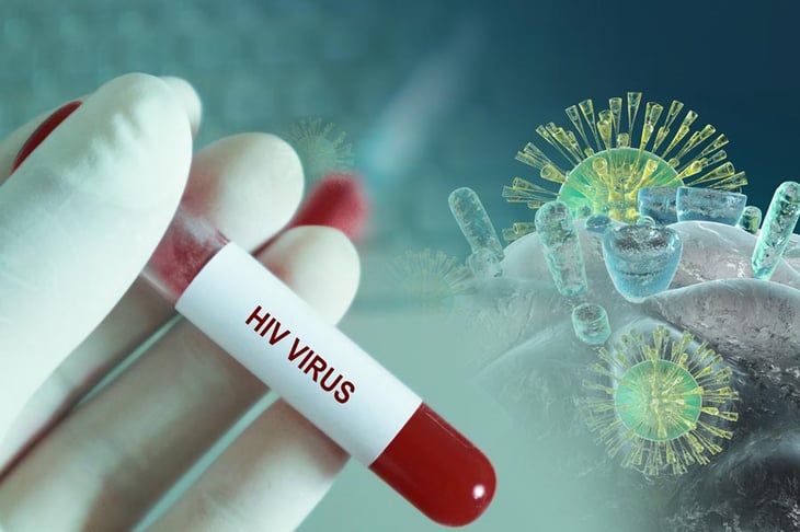Sólo 3 de cada 10 personas con VIH tienen acceso a antirretrovirales