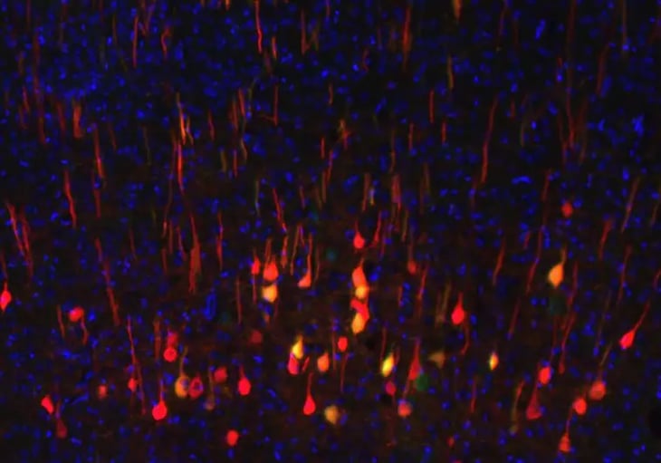 Este biomarcador predice qué neuronas se regenerarán