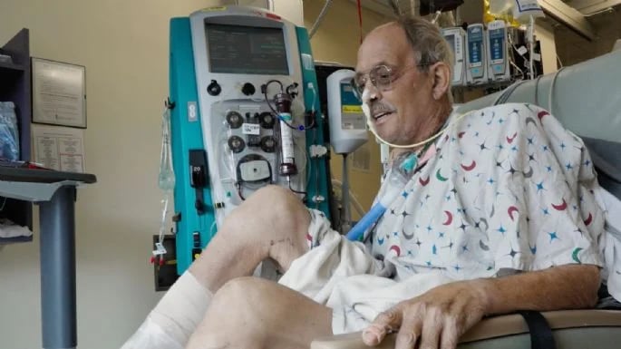 Un mes después de un trasplante de corazón porcino, paciente no muestra señales de rechazo