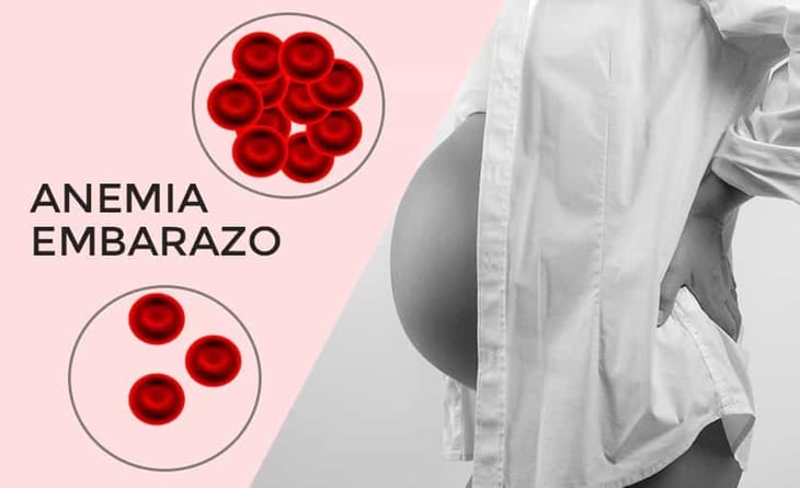 Embarazo en las enfermedades reumáticas: la anemia y la ferropenia son altamente prevalentes