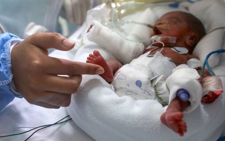 Bebés prematuros saturan terapia neonatal en  Amparo Pape