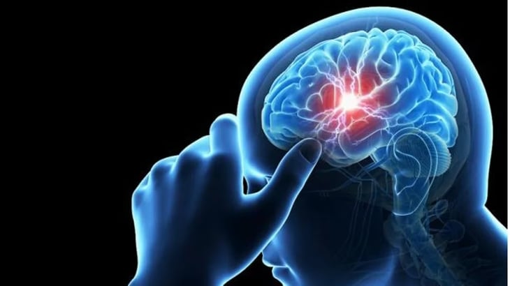 “El tiempo es cerebro”: la importancia de la detección precoz y la rehabilitación tras un ACV