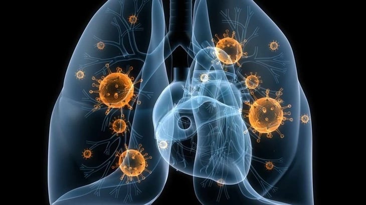 Nivolumab perioperatorio en cáncer de pulmón de células no pequeñas resecable