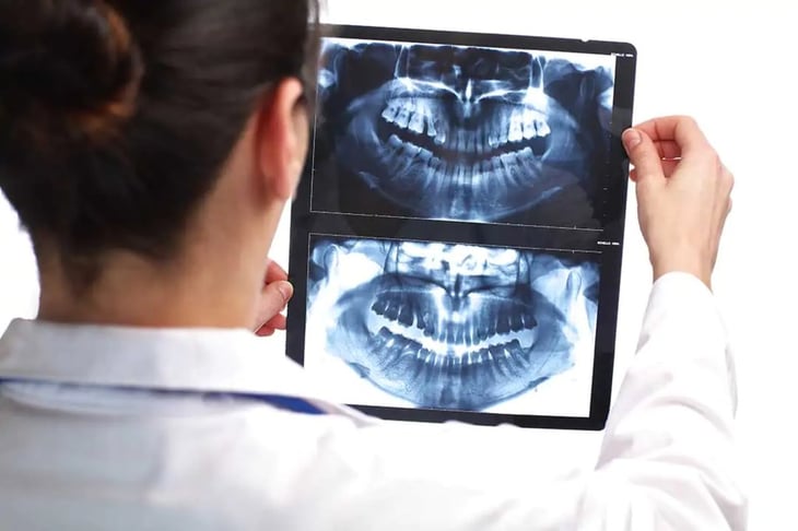 Las radiografías dentales son más seguras que nunca