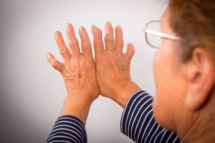 Un nuevo tratamiento no quirúrgico puede ayudar a los pacientes con artritis